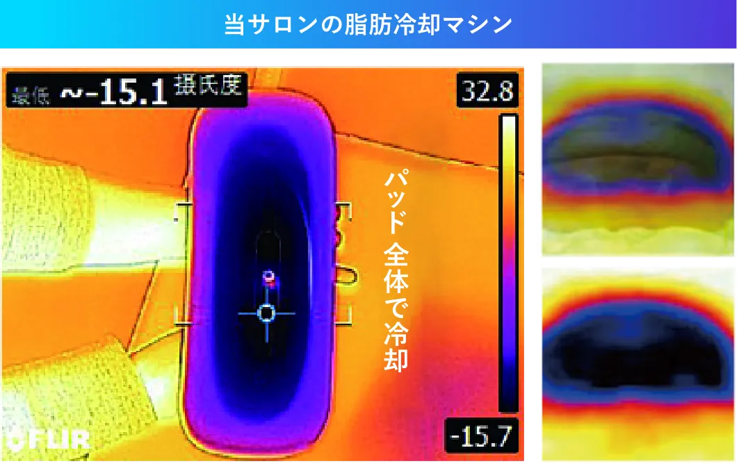 当サロンの脂肪冷却マシン