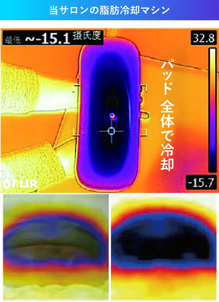 当サロンの脂肪冷却マシン